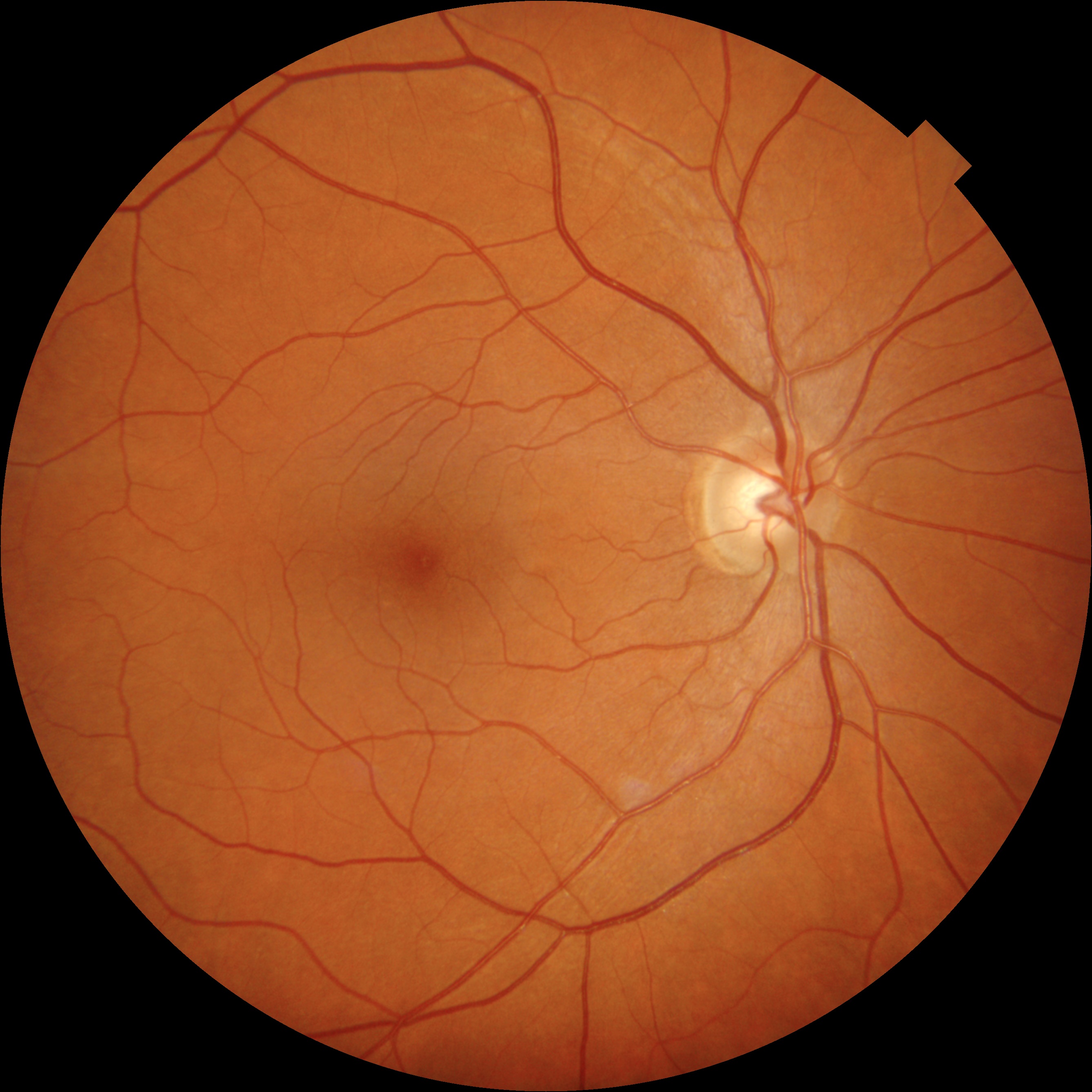 Fundus image
